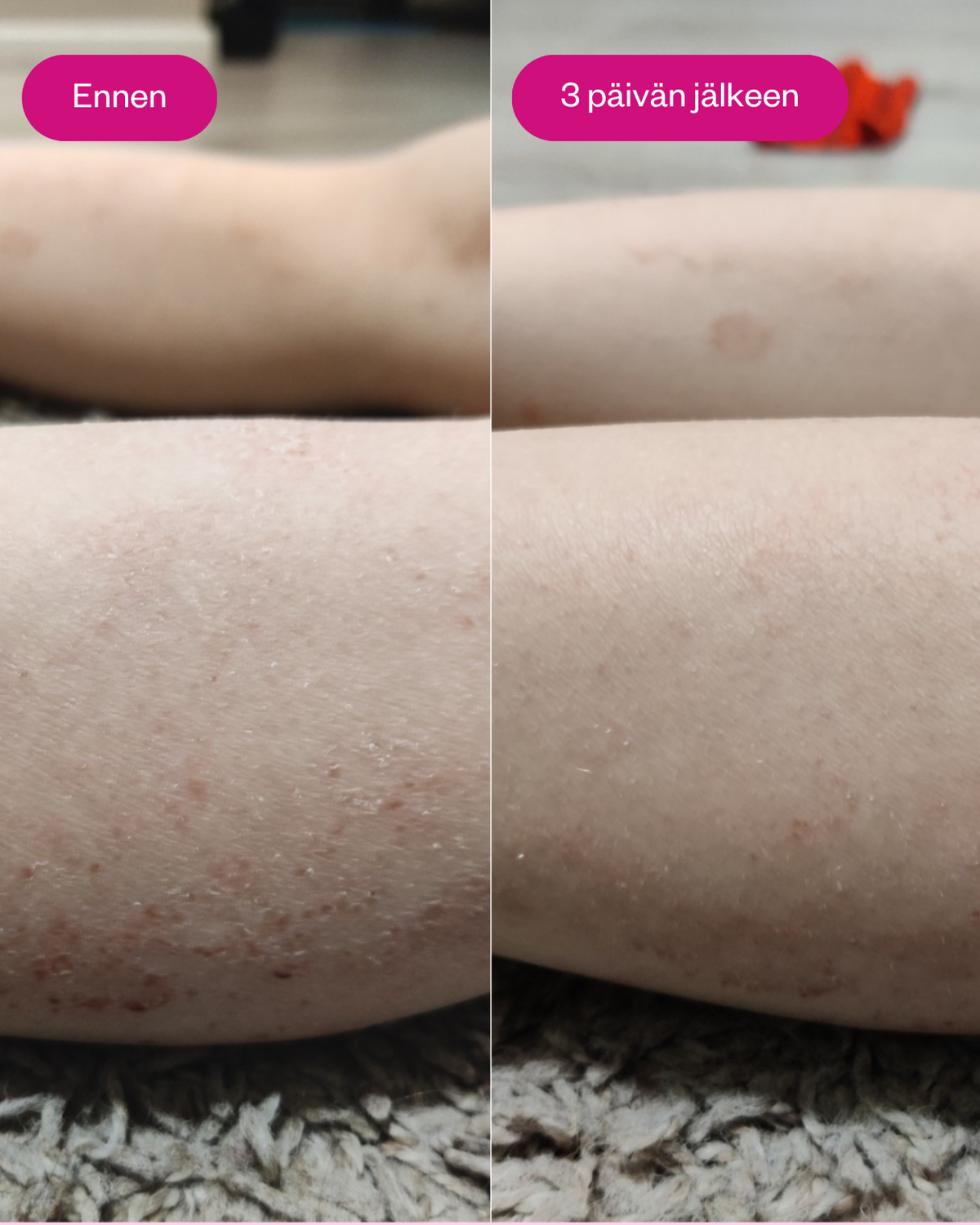 Propolis & Probiotics Rescue Cream erikoisvoide ongelmaiholle